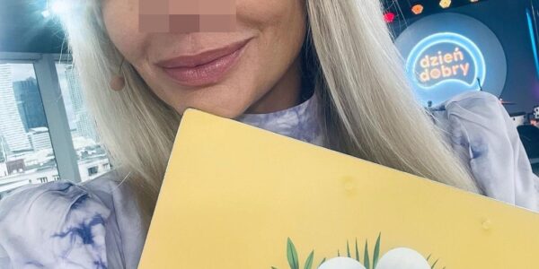 Agnieszka Woźniak-Starak, nos, piegi